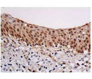 Myc Antibody (SPM237) - Immunohistochemistry - Image 348017 