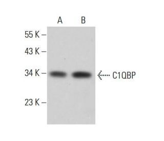C1QBP Antibody (1.T.22) - Western Blotting - Image 376593 