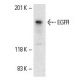 C3H/10T1/2 Cell Lysate: sc-3801. Western blot analysis of EGFR expression... 