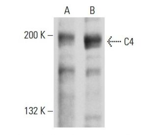 C4 Antibody (16D2) - Western Blotting - Image 32850