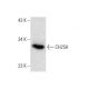 c4 Whole Cell Lysate: sc-364186. Western blot analysis of CH25H... 