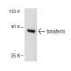 c4 Whole Cell Lysate: sc-364186. Western blot analysis of transferrin...