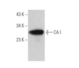 CA I Antibody (C-7) - Western Blotting - Image 374516 