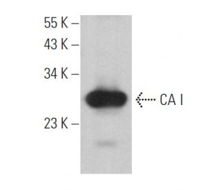 CA I Antibody (D-4) - Western Blotting - Image 364702 