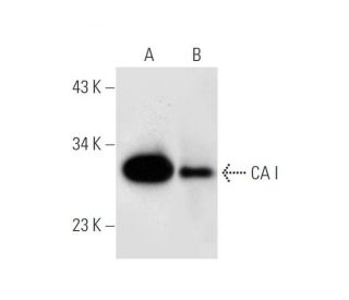 CA I Antibody (F-11) - Western Blotting - Image 305644 