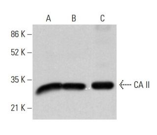 CA II Antibody (D-11) - Western Blotting - Image 380547 