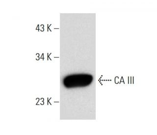 CA III Antibody (E-3) - Western Blotting - Image 306617