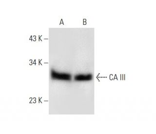 CA III Antibody (E-4) - Western Blotting - Image 303350 