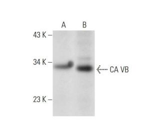 CA VB Antibody (G-1) - Western Blotting - Image 299147