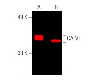 CA VI Antibody (F-12) - Western Blotting - Image 387633 