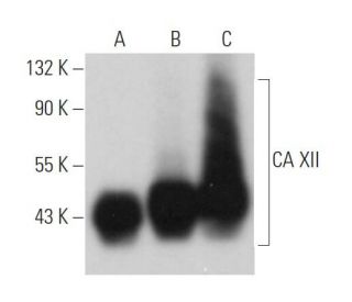 CA XII Antibody (D-2) - Western Blotting - Image 362347 