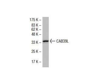 CAB39L Antibody (Q32) - Western Blotting - Image 33766Each CRISPR/Cas9 Knockout (KO) Plasmid product consists of a pool of 3 plasmids designed to ensure identification and cleavage of a specific gene for maximum knockout efficiency. Each plasmid encodes a unique 20 nt sequence derived from the GeCKO (v2) library.