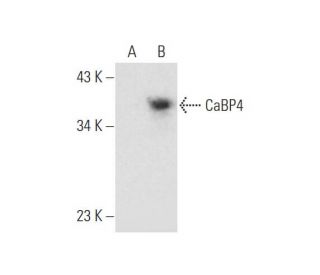 CaBP4 Antibody (H-9) - Western Blotting - Image 332768