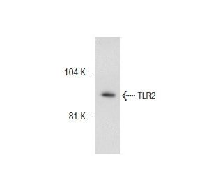 TLR2 Antibody (TL2.3) - Western Blotting - Image 145754 