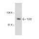 TLR2 Antibody (TL2.3) - Western Blotting - Image 145754 
