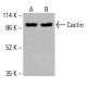 MALT1 抗体 (D-1):sc-515389。通过 Western blot 分析 HeLa (A)、K-562 (B) 和 HCT-116 (C) 细胞的完整细胞裂解物中 MALT1 的表达。使用的检测试剂:m-IgG Fc BP-HRP:sc-525409。 Cactin Antibody (D-10) - Western Blotting - Image 415992