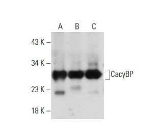 CacyBP Antibody (D-8) - Western Blotting - Image 129927 