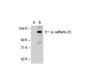 cadherin-23 Antibody (G-11) - Western Blotting - Image 62426