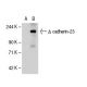 cadherin-23 Antibody (G-11) - Western Blotting - Image 62426