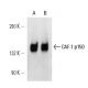 CAF-1 p150 Antibody (SS 1 1-13) - Western Blotting - Image 14848 