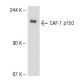 CAF-1 p150 Antibody (SS 1 1-13) - Western Blotting - Image 51311