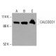 抗体 GLI-1/GLI1 (C-1):sc-515751。Western blot 分析未处理的 HeLa(A)、化学处理的 HeLa(B)和 HCT-116 (C) 完整细胞裂解液中 GLI-1 的表达。β-肌动蛋白 (C4):sc-47778 用作加载对照。使用的检测试剂:m-IgG Fc BP-HRP:sc-525409。 CALCOCO1 Antibody (A-10) - Western Blotting - Image 416077