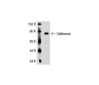 Caldesmon Antibody (C21) - Western Blotting - Image 31220