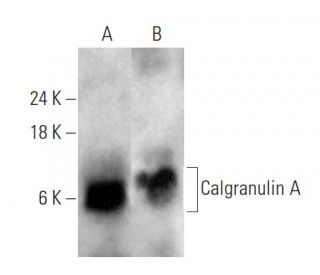 Calgranulin A Antibody (CF145) - Western Blotting - Image 353692 
