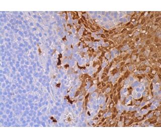 Calgranulin B Antibody (MRP 1H9) - Immunohistochemistry - Image 387731 