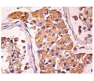 Calpain 11 Antibody (C-2) - Immunohistochemistry - Image 158001 