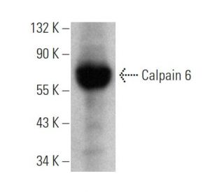 Calpain 6 Antibody (1395CT446.22.5) - Western Blotting - Image 374603SAM Transcription Activation: SAM system utilizing dCas9-VP64, MS2-P65-HSF1, and sgRNA for precise gene transcription activation. 
