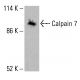 Exo84 抗体 (H-1):sc-515532。Western blot 分析 HeLa (A)、K-562 (B) 和 HCT-116 (C) 完整细胞裂解物中 Exo84 的表达 。使用的检测试剂:m-IgG Fc BP-HRP:sc-525409。 Calpain 7 Antibody (F-10) - Western Blotting - Image 416033