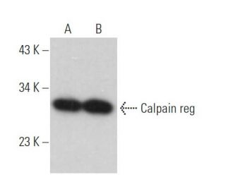 Calpain reg Antibody (P-1) - Western Blotting - Image 369793 
