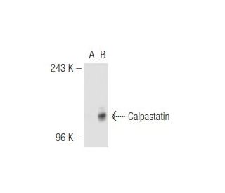 Calpastatin Antibody (PI-11) - Western Blotting - Image 45925