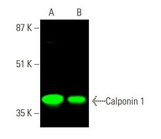 Calponin 1 Antibody (CALP) - Western Blotting - Image 381981 