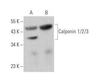 Calponin 1/2/3 Antibody (H-3) - Western Blotting - Image 374357Each CRISPR/Cas9 Knockout (KO) Plasmid product consists of a pool of 3 plasmids designed to ensure identification and cleavage of a specific gene for maximum knockout efficiency. Each plasmid encodes a unique 20 nt sequence derived from the GeCKO (v2) library.