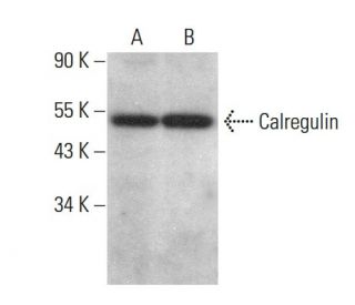 Calregulin Antibody (1G6A7) - Western Blotting - Image 377995 