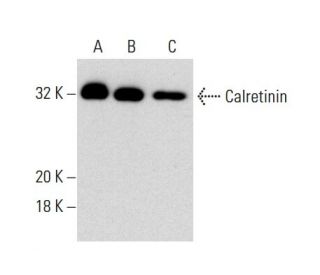 Calretinin Antibody (34) - Western Blotting - Image 137889 