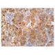 Calretinin Antibody (B-8) - Immunohistochemistry - Image 161073 