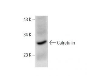 Calretinin Antibody (B-8) - Western Blotting - Image 143575 
