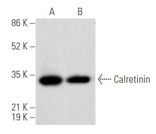 Calretinin Antibody (D-12) - Western Blotting - Image 355546 