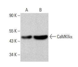 CAMK2A/CaMKII alpha Antibody (A-1) - Western Blotting - Image 380239