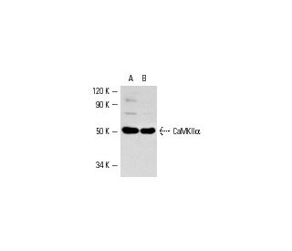 CAMK2A/CaMKII alpha Antibody (A-1) - Western Blotting - Image 2227 