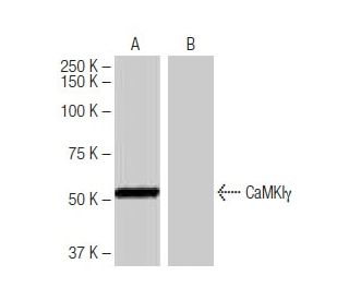 CaMKI&gamma; Antibody (10G8) - Western Blotting - Image 64886