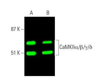 CaMKII Antibody (G-1) - Western Blotting - Image 371788 