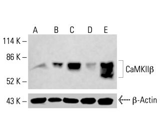 CaMKII beta Antibody (D-6) - Western Blotting - Image 414844