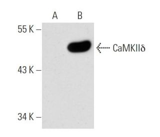 CaMKII delta Antibody (L-04) - Western Blotting - Image 31626The Double Nickase Plasmid features a U6 promoter for sgRNA expression, a 20 nt targeting sequence, and a gRNA scaffold to guide Cas9n. It includes a CBh promoter for Cas9n (D10A) and puromycin resistance, GFP for transfection verification, and nuclear localization signals (NLS). The 2A peptide allows co-expression of Cas9n and Puro from a single promoter, enabling precise genome editing with reduced off-target effects.