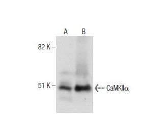 CAMK2A/CaMKII alpha Antibody (45) - Western Blotting - Image 281742