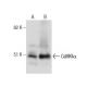 CAMK2A/CaMKII alpha Antibody (45) - Western Blotting - Image 281742