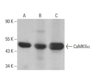 CAMK2A/CaMKII alpha Antibody (6G9) - Western Blotting - Image 380232 